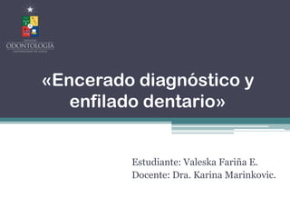 «Encerado diagnóstico y
enfilado dentario»
Estudiante: Valeska Fariña E.
Docente: Dra. Karina Marinkovic.
 