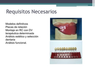 Requisitos Necesarios
lModelos definitivos
lPlacas de relación
lMontaje en RC con DV
lterapéutica determinada
lAnálisis estético y selección
ldentaria
lAnálisis funcional.
 
