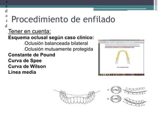 Procedimiento de enfiladoP
r
e
p
a
r
lTener en cuenta:
lEsquema oclusal según caso clínico:
Oclusión balanceada bilateral
Oclusión mutuamente protegida
lConstante de Pound
lCurva de Spee
lCurva de Wilson
lLínea media
 