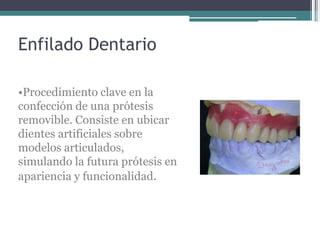 Enfilado Dentario
•Procedimiento clave en la
confección de una prótesis
removible. Consiste en ubicar
dientes artificiales sobre
modelos articulados,
simulando la futura prótesis en
apariencia y funcionalidad.
 