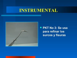INSTRUMENTAL
 PKT No 3: Se usa
para refinar los
surcos y fisuras
 