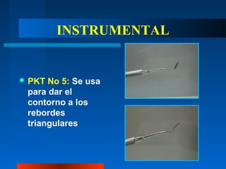 INSTRUMENTAL
 PKT No 5: Se usa
para dar el
contorno a los
rebordes
triangulares
 
