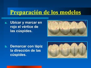 Preparación de los modelos
a. Ubicar y marcar en
rojo el vértice de
las cúspides.
b. Demarcar con lápiz
la dirección de las
cúspides.
 