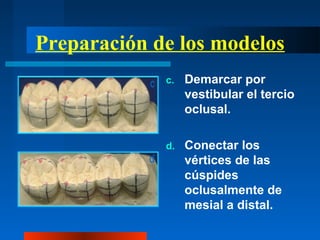 Preparación de los modelos
c. Demarcar por
vestibular el tercio
oclusal.
d. Conectar los
vértices de las
cúspides
oclusalmente de
mesial a distal.
 