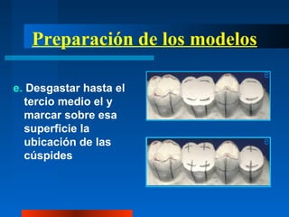 Preparación de los modelos
e. Desgastar hasta el
tercio medio el y
marcar sobre esa
superficie la
ubicación de las
cúspides
 