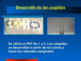 Desarrollo de las cuspides
Se utiliza el PKT No 1 y 2. Las cúspides
se desarrollan a partir de los conos y
hacia los rebordes marginales
 