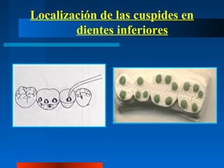 Localización de las cuspides en
dientes inferiores
 