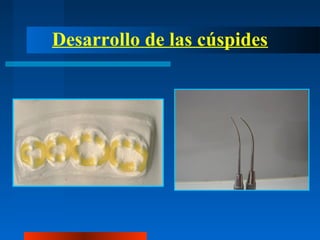 Desarrollo de las cúspides
 