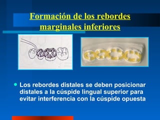 Formación de los rebordes
marginales inferiores
 Los rebordes distales se deben posicionar
distales a la cúspide lingual superior para
evitar interferencia con la cúspide opuesta
 