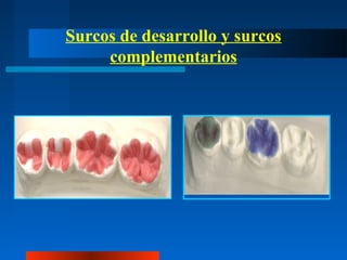 Surcos de desarrollo y surcos
complementarios
 