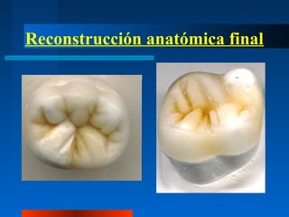 Reconstrucción anatómica final
 
