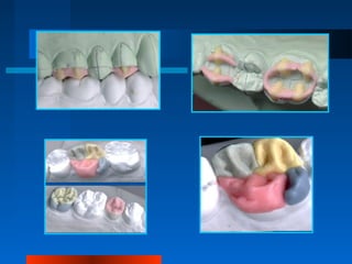 Encerado en odontologia