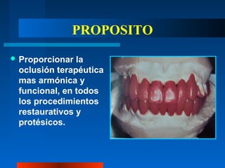 PROPOSITO
 Proporcionar la
oclusión terapéutica
mas armónica y
funcional, en todos
los procedimientos
restaurativos y
protésicos.
 