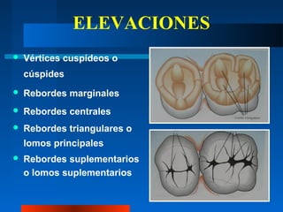ELEVACIONES
 Vértices cuspídeos o
cúspides
 Rebordes marginales
 Rebordes centrales
 Rebordes triangulares o
lomos principales
 Rebordes suplementarios
o lomos suplementarios
 