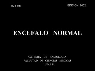 TC Y RM                            EDICION 2002




 ENCEFALO NORMAL


             CATEDRA DE RADIOLOGIA
          FACULTAD DE CIENCIAS MEDICAS
                      U.N.L.P
 