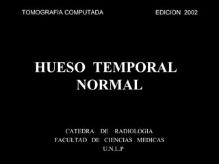 TOMOGRAFIA COMPUTADA            EDICION 2002




   HUESO TEMPORAL
       NORMAL

          CATEDRA DE RADIOLOGIA
       FACULTAD DE CIENCIAS MEDICAS
                   U.N.L.P
 