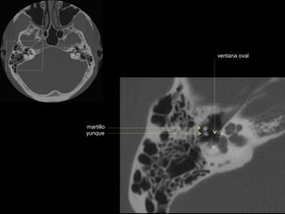 ventana oval




martillo
yunque
 