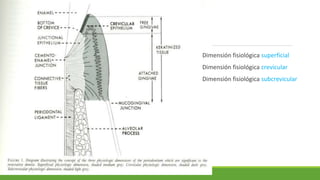 Dimensión fisiológica superficial
Dimensión fisiológica crevicular
Dimensión fisiológica subcrevicular
 