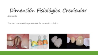 Dimensión Fisiológica Crevicular
Anatomía
Proceso restaurativo puede ser de un daño crónico
 