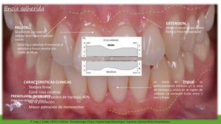 Encía adherida
CARACTERISTICAS CLINICAS.
- Textura firme
- Color rosa coralino
- Rugosidad (Cascara de naranja) 40%
de la población
- Mayor población de melanocitos
EXTENSION.
Desde el surco marginal libre
hasta la línea mucogingival
Encía fija o adherida firmemente al
periostio y hueso alveolar por
medio de fibras.
PREMOLARES INFERIORES
Zona mas delgada de encía
adherida.
La encía de lingual es
particularmente estrecha en la zona
de incisivos y ancha en la región de
molares. La variación oscila entre 1
mm y 9 mm
PALATAL.
Se extiende por todo el
paladar duro hasta el paladar
blando
P. Lang, J. Lindhe. (2016), 6 Edición . Periodontología Clínica e Implantología Odontológica. Argentina: Editorial Medica Panamericana.
 