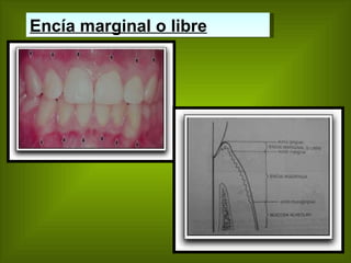 Encía marginal o libre   