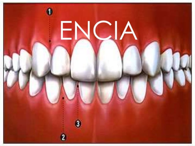 Encias