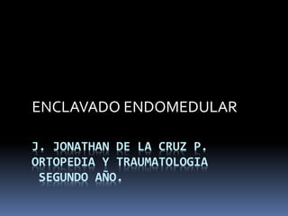 ENCLAVADO ENDOMEDULAR 
J. JONATHAN DE LA CRUZ P. 
ORTOPEDIA Y TRAUMATOLOGIA 
SEGUNDO AÑO. 
 