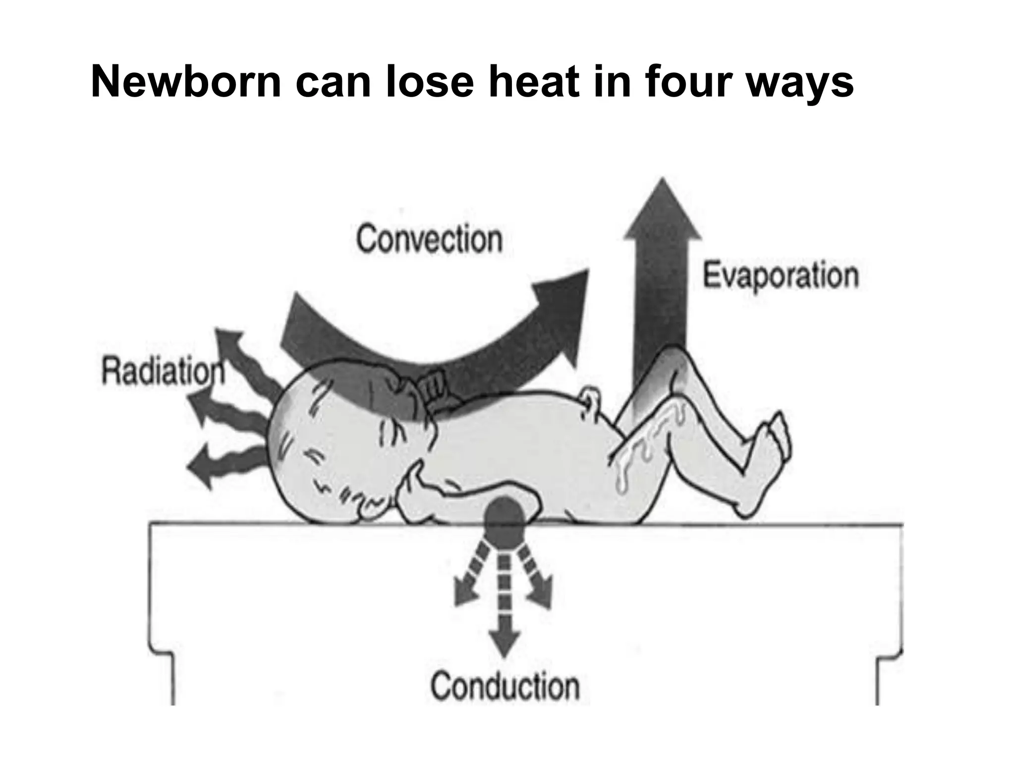 Newborn can lose heat in four ways
 