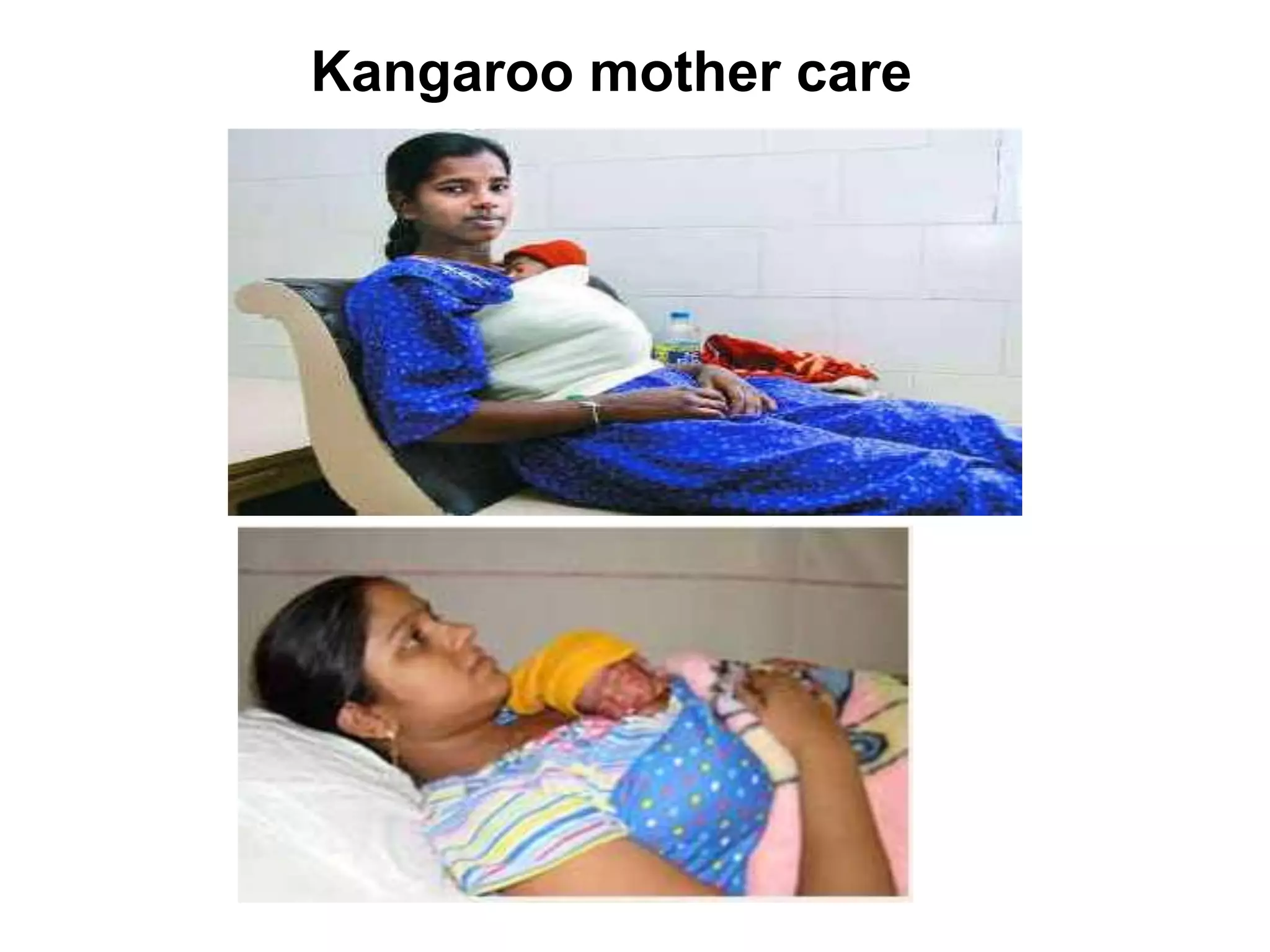 Kangaroo mother care
 
