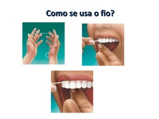 Como se usa o fio?
 