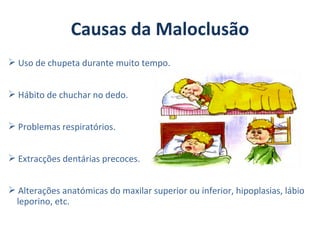 Causas da Maloclusão
 Uso de chupeta durante muito tempo.


 Hábito de chuchar no dedo.


 Problemas respiratórios.


 Extracções dentárias precoces.


 Alterações anatómicas do maxilar superior ou inferior, hipoplasias, lábio
 leporino, etc.
 