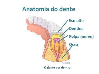 Anatomia do dente
                       Esmalte
                       Dentina
                       Polpa (nervo)
                       Osso




      O dente por dentro
 