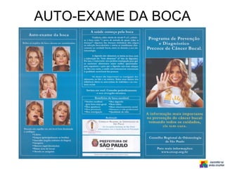 AUTO-EXAME DA BOCA
 