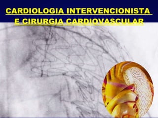 CARDIOLOGIA INTERVENCIONISTA  E CIRURGIA CARDIOVASCULAR 