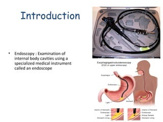 Introduction

• Endoscopy : Examination of
internal body cavities using a
specialized medical instrument
called an endoscope

 
