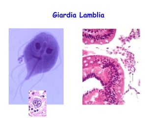 Giardia Lamblia

 