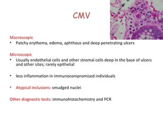CMV
Macroscopic
• Patchy erythema, edema, aphthous and deep penetrating ulcers
Microscopic
• Usually endothelial cells and other stromal cells deep in the base of ulcers
and other sites; rarely epithelial
•

less inflammation in immunocompromised individuals

•

Atypical inclusions: smudged nuclei

Other diagnostic tests: immunohistochemistry and PCR

 