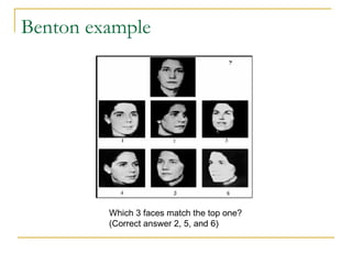 Benton example Which 3 faces match the top one?  (Correct answer 2, 5, and 6) 