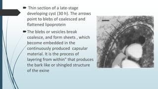 Bleb Structure Encystation | PPTX