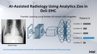 AI-Assisted Radiology Using Analytics Zoo in
Dell EMC
Condition E
Condition D
Condition C
Condition B
Condition A
Patient A
Transfer Learning using ResNet-50 trained with ImageNet
https://www.delltaechnologies.com/resources/en-us/asset/white-papers/solutions/h17686_hornet_wp.pdf
chest X-rays
 