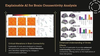 End-to-End Stroke Imaging Analysis Using Effective Connectivity and ...