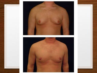 Semiología Endócrino