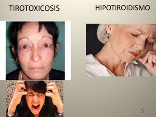 Semiología Endócrino