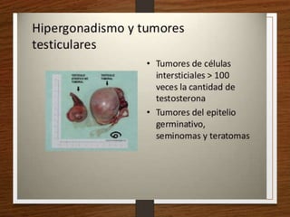 Semiología Endócrino