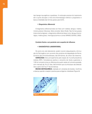 72
tipo bexiga neurogênica e paralisias. A instituição precoce do tratamento
até o quinto dia após o início da sintomatologia melhora o prognóstico e
baixa a letalidade das formas graves para 6,5%.
•	 Diagnóstico diferencial
O diagnóstico diferencial deve ser feito com rubéola, dengue, malária,
mononucleose infecciosa, febre amarela, febre tifoide. Nas formas graves
(ictero-hemorrágicas), o diagnóstico diferencial deve incluir dengue hemor-
rágica, malária grave, meningococcemia e outras (MINAS GERAIS, 2002).
Conduta frente a um paciente com suspeita de influenza
•	 DIAGNÓSTICO LABORATORIAL
Do ponto de vista laboratorial, podem ocorrer plaquetopenia, diminui-
ção do fibrinogênio com aumento dos produtos de degradação da fibrina,
aumento das aminotransferases, das bilirrubinas, da ureia e da creatinina.
SOROLOGIA: feito principalmente pela reação de imunofluorescência
indireta (RIFI). Considera-se positivo o encontro de títulos superiores a
1:64 em amostra única ou diferença de quatro vezes em amostra pareada,
com intervalo de 14 a 21 dias. Vale lembrar que os anticorpos são detectá-
veis a partir do 5º ao 7º dia de doença.
IMUNO-HISTOQUÍMICA: realizada em amostras de tecidos. Confirma
a doença quando a reação é positiva para antígenos rickettsiais (Figura 9).
Figura 9 - R. rickettsii em célula endotelial
Fonte:www.cdc.gov
 