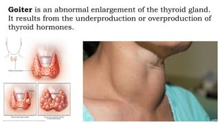 endocrine System for Science 10 Quarter three .pptx