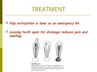 Endodontic Emergencies and their management | PPT