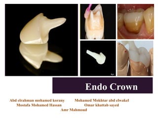 A
+
Endo Crown
Abd elrahman mohamed korany Mohamed Mokhtar abd elwakel
Mostafa Mohamed Hassan Omar khattab sayed
Amr Mahmoud
 