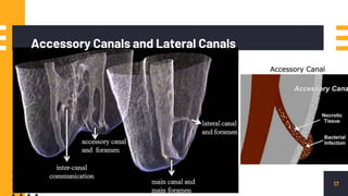 17
Accessory Canals and Lateral Canals
 