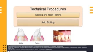 46
Technical Procedures
Scaling and Root Planing
Acid Etching
Gold S, Hasselgren G. Peripheral inflammatory root resorption: A review of literature with case reports. J Clin Periodontol 1992;19:523-34.
Adriaens PA, De Boever JA, Loesche WJ. Bacterial invasion of root cementum and radicular dentin of periodontally diseased teeth in humans: A reservoir of periodontopathic bacteria. J Periodontol
1988;59:222-30.
Cotton WR, Siegel RL. Human pulpal response to citric acid cavity cleanser. J Am Dent Assoc 1978;96:639-44.
 